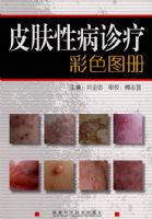 Ƥ���Բ����Ʋ�ɫͼ��