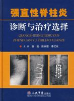 ǿֱ�Լ��������������ѡ��