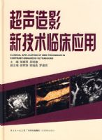 ������Ӱ�¼����ٴ�Ӧ��