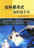 ��������ʽ��ǻ������