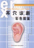 ��Ѩ��ϲ�ɫͼ��