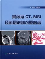 ��­��CT��MRI���׶ϲ���ʶ���ͼ��