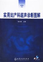 ʵ�ø����Ƴ������ͼ��