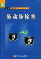 �ζ���˨��