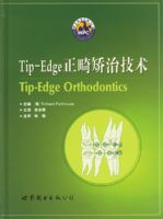Tip-Edge�������μ���