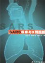SARS�ٴ���X��ͼ��