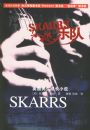SKARRS�ֶ�